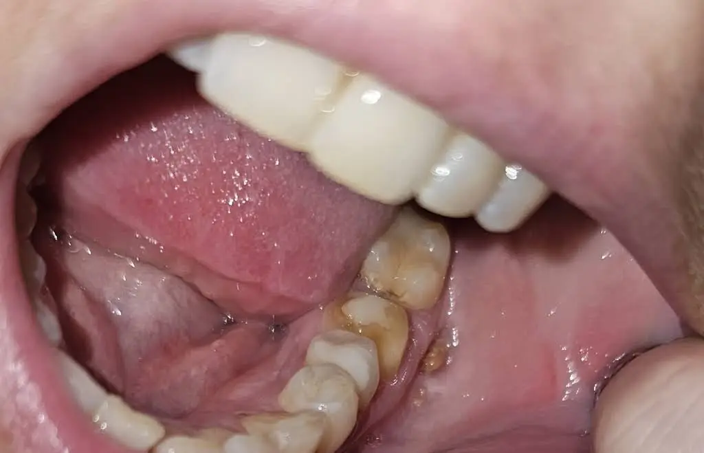 Rapids Dental