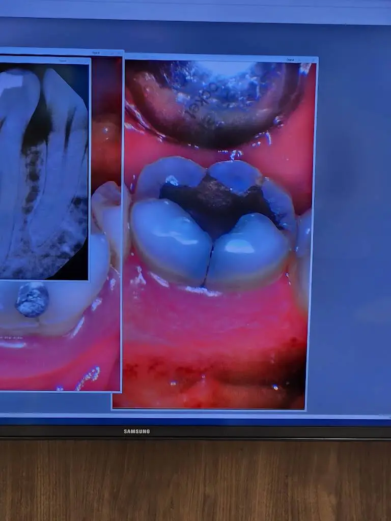 Premier Dental Group of Merrillville