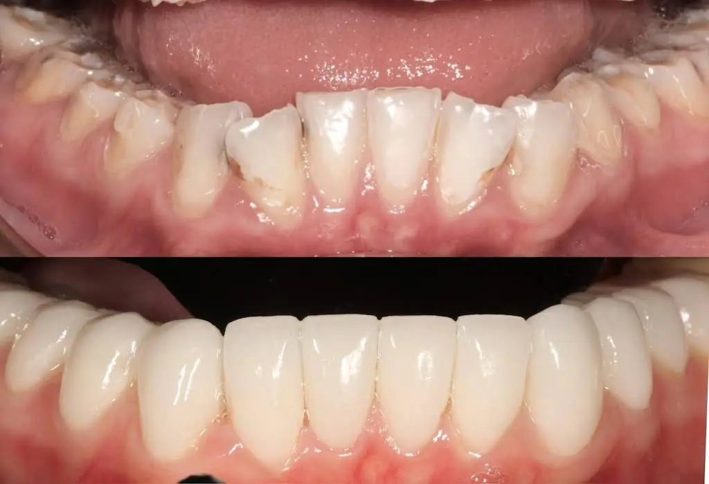 Rockville Dental