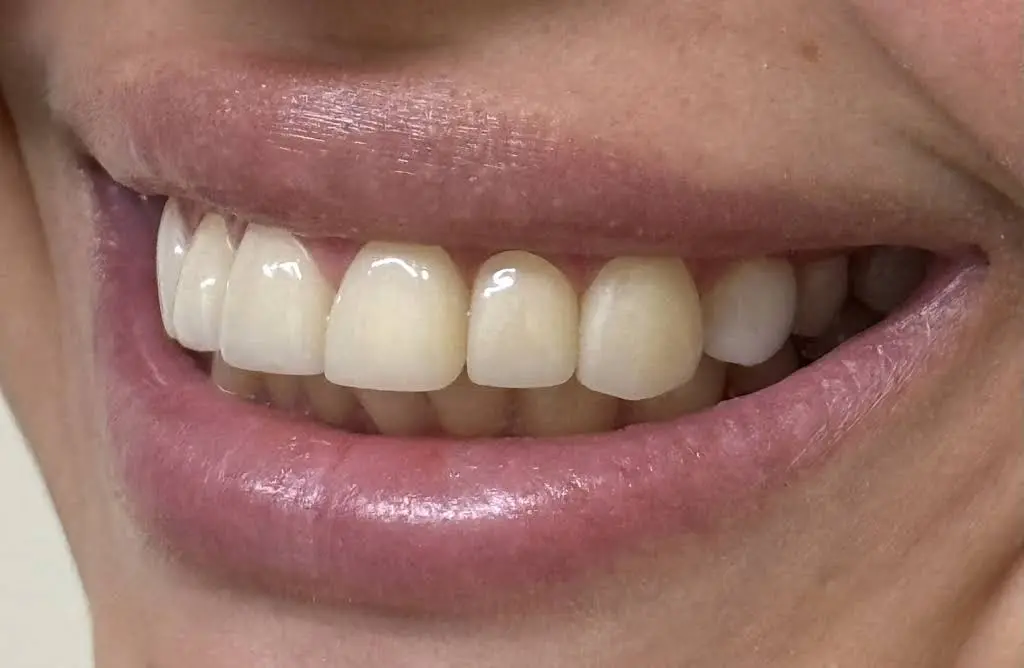 Gentle Care Cosmetic Dental