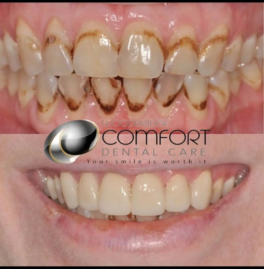 Woodbridge Comfort Dental Care