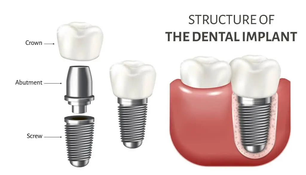 International Dental Center