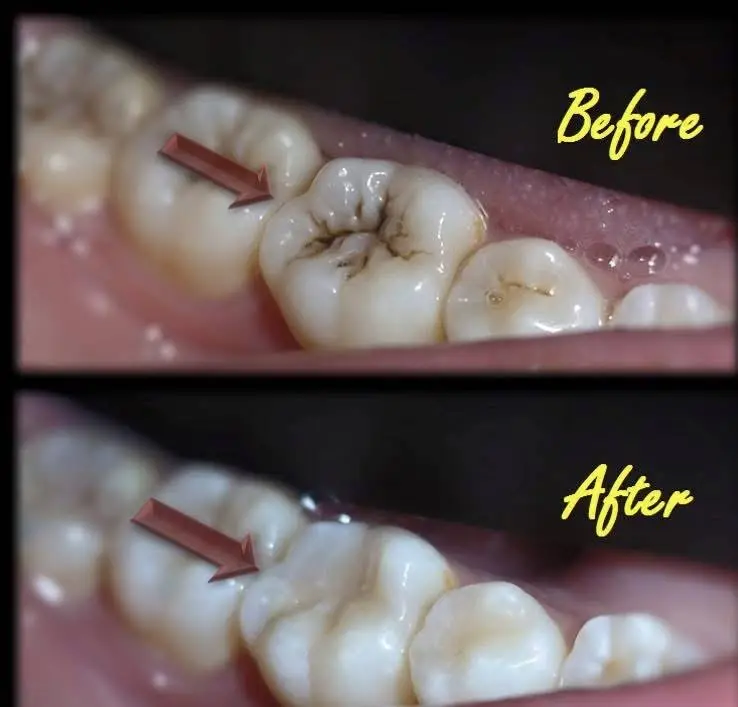 International Dental Center