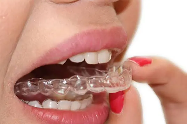 Ultimate Dental Care