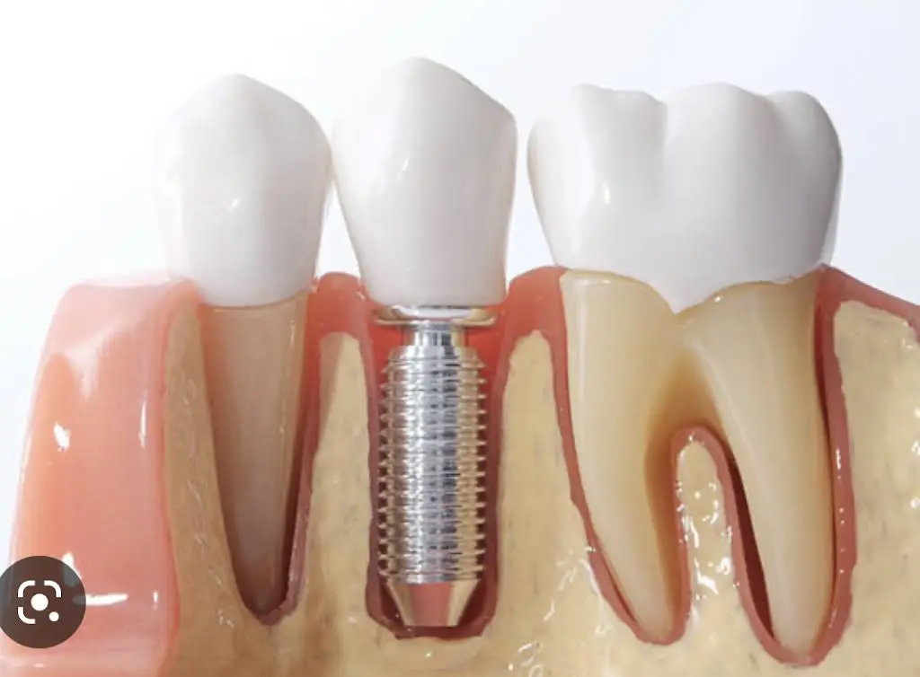 Ultimate Dental Care