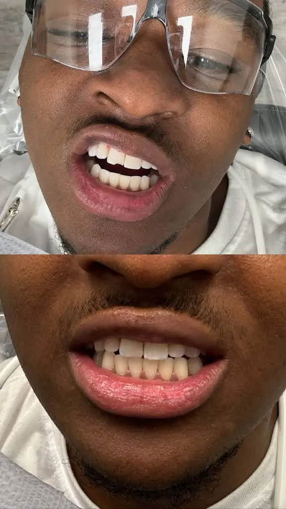 Ultimate Dental Care