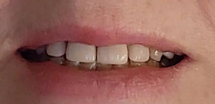 Cudahy Dental Associates
