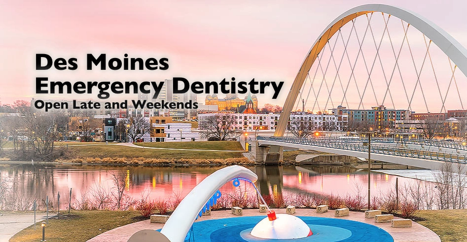 Emergency Dentist Des Moines