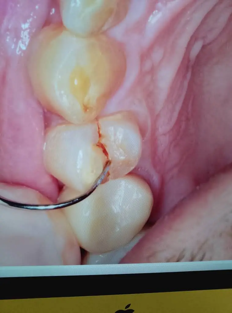 Aspen Dental