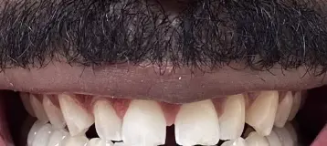 Smile Loft Glen Burnie