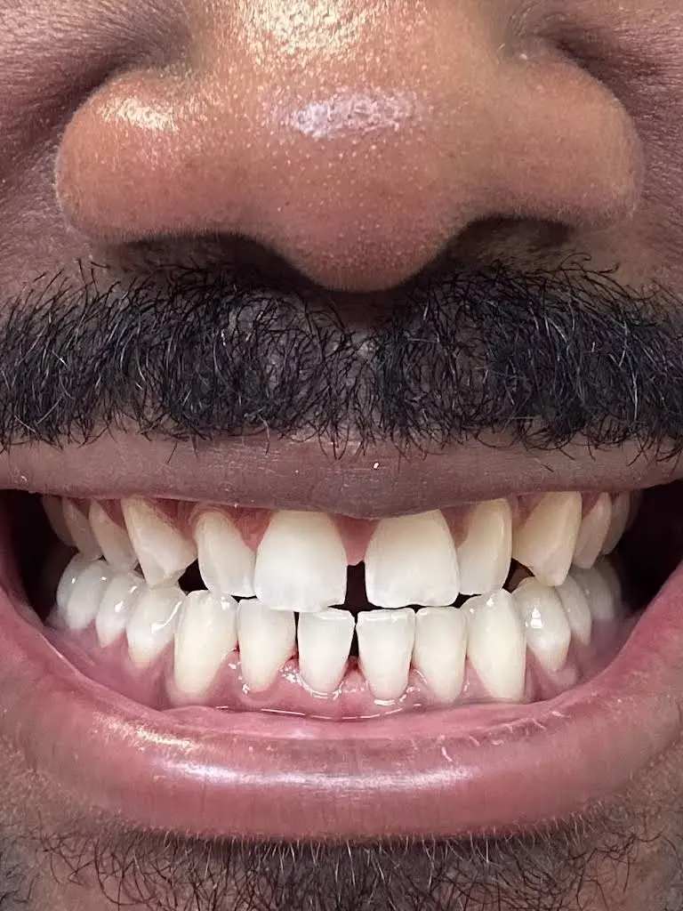 Smile Loft Glen Burnie