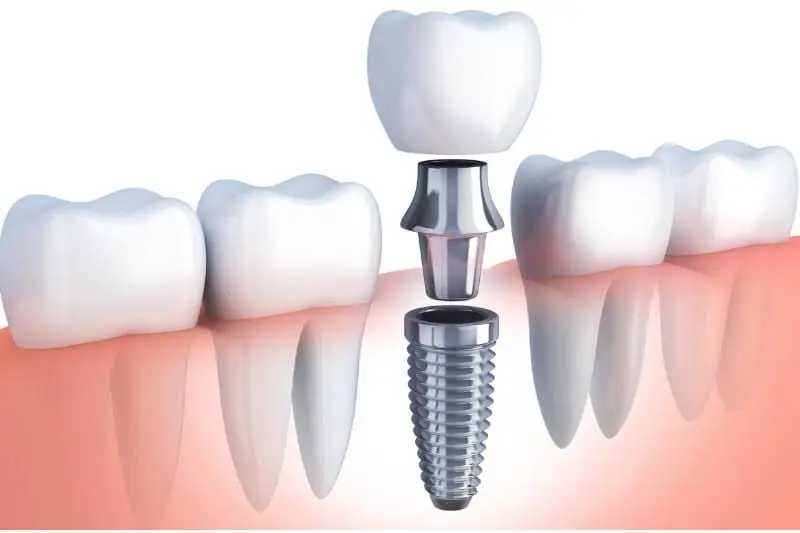 Glen Burnie Dental Group