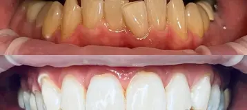 Riverside Family Dental