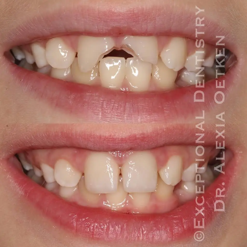 Exceptional Dentistry of the Tri-State Region