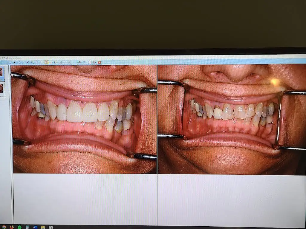 The Dental Center Hiawatha