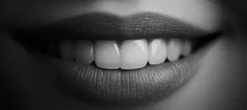 Optic White Teeth Whitening Studio