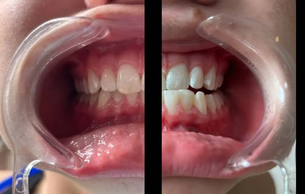 Optic White Teeth Whitening Studio