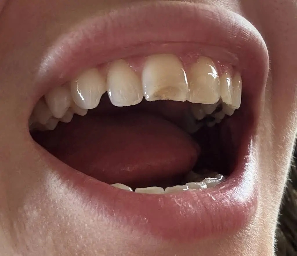 Emergency Dental Care USA