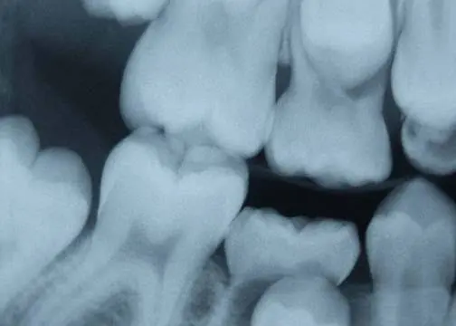 Popovich Dental