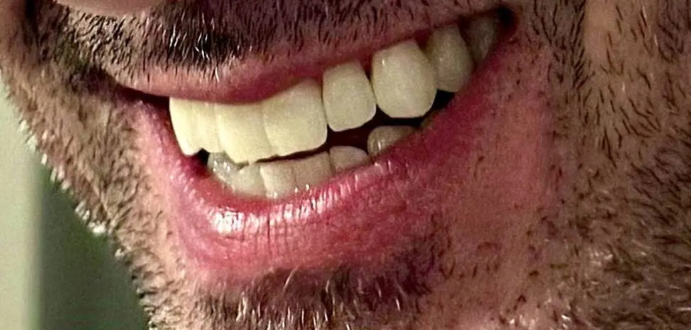 Crown Point Dental Care