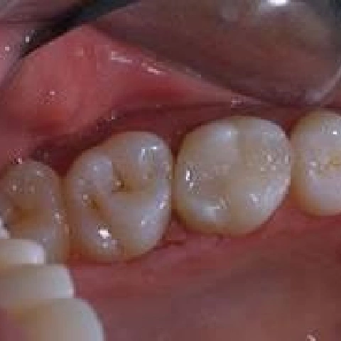 Millersville Family Dentistry