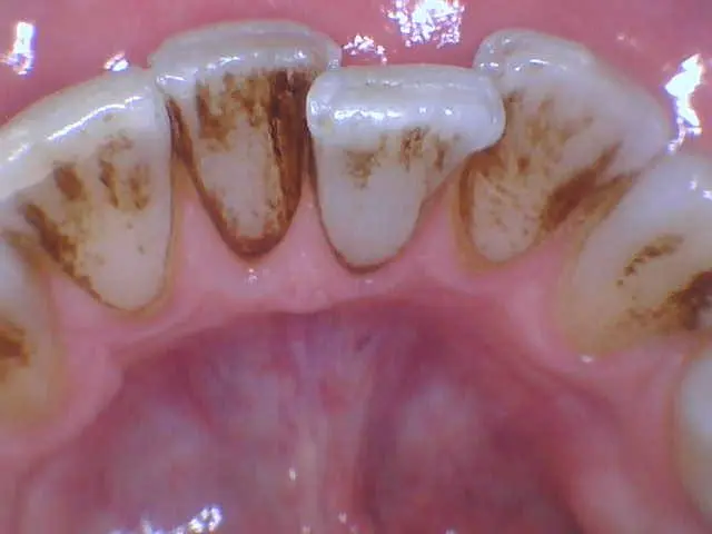 Crownsville Dental & Wellness Solutions