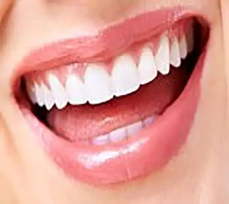 Reston Dental Care