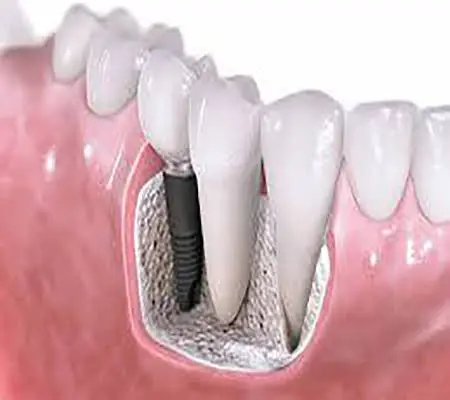 Reston Dental Care