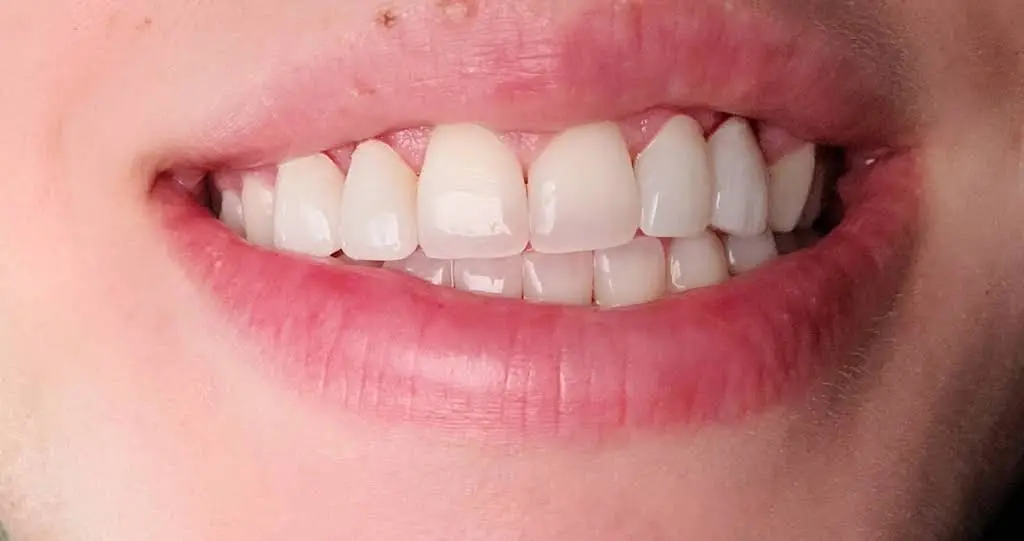 Dental Serenity - Dumfries