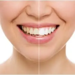 Madison Family Dental Associates