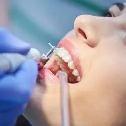 Madison Family Dental Associates