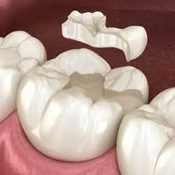 Madison Family Dental Associates