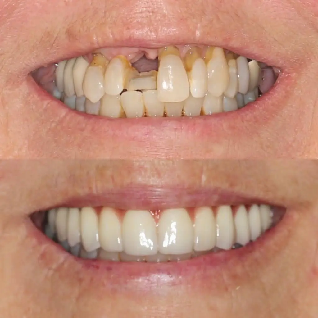 Djawdan Center for Implant & Restorative Dentistry