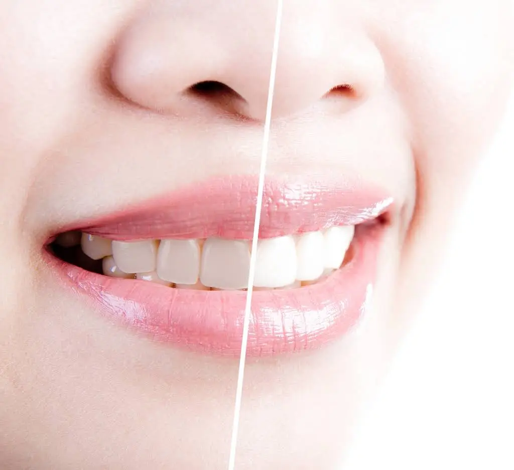 SmileLine Dental