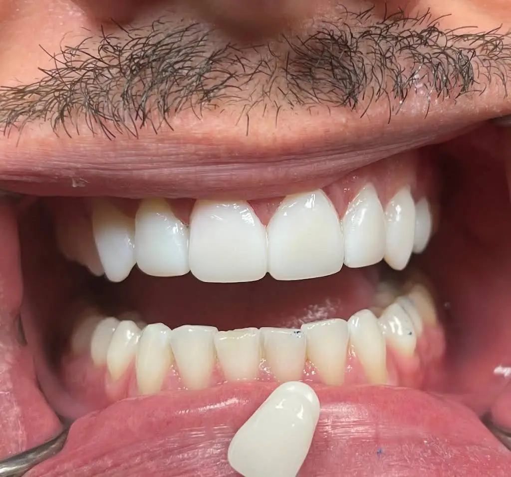 Lowes Island Dentistry