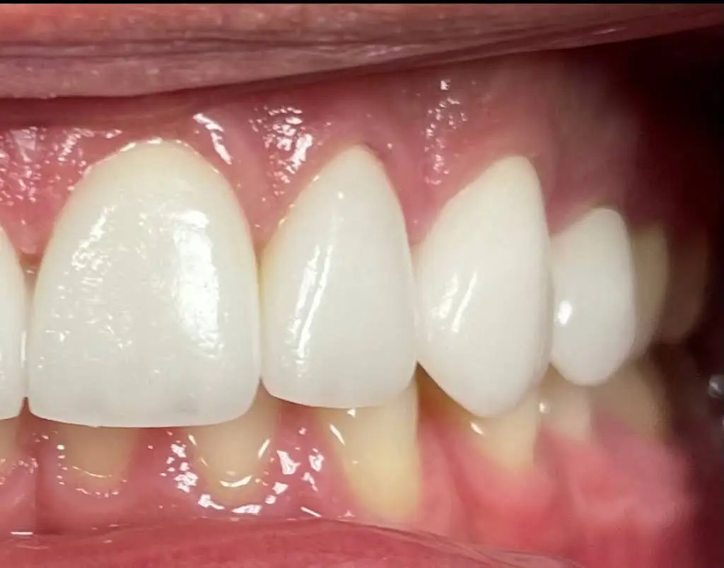 Lowes Island Dentistry