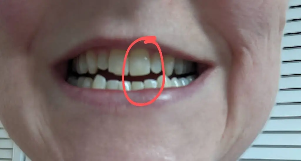 Herndon Smiles