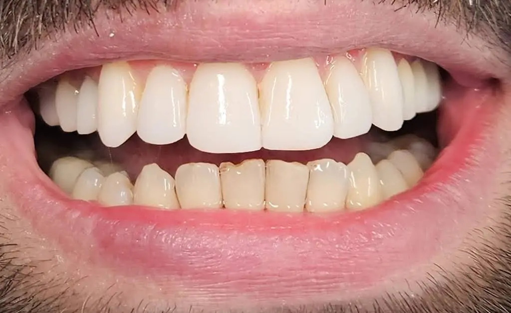 Reston Family Dental Center