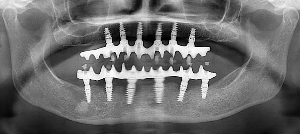 Ridgetop Dental - Reston