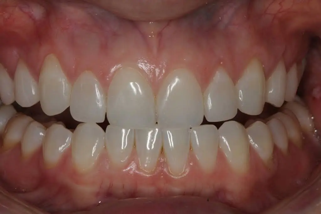 Ridgetop Dental - Reston