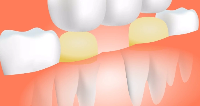 Acclaim Dental Group