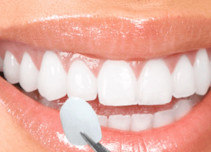 Acclaim Dental Group
