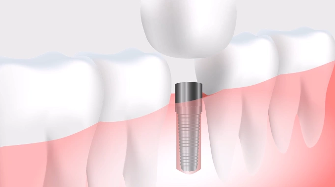 Acclaim Dental Group