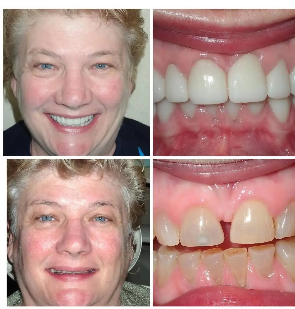 Reston Heights Dental