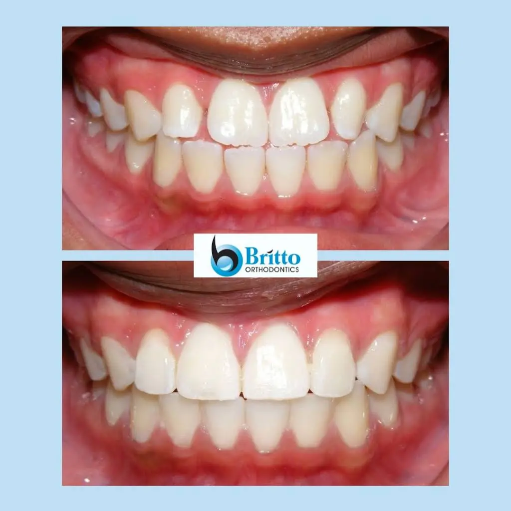 Britto Orthodontics