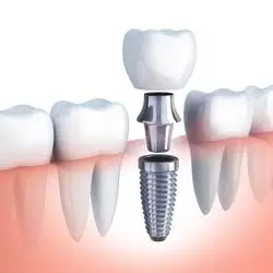 Madison Family Dental Associates - DeForest