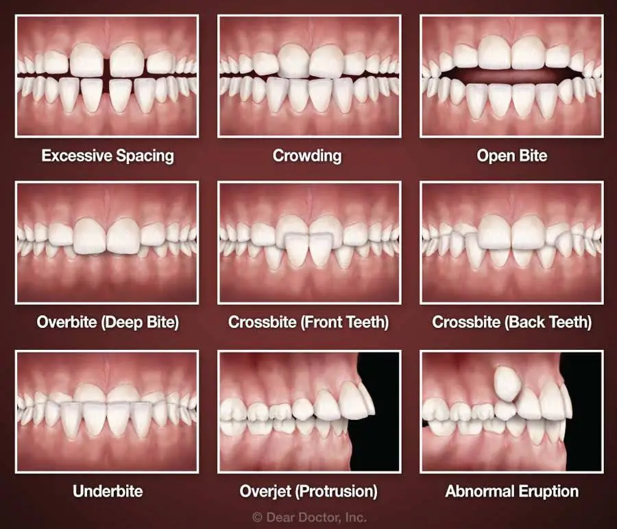 Smile Doctors Orthodontics - Madison