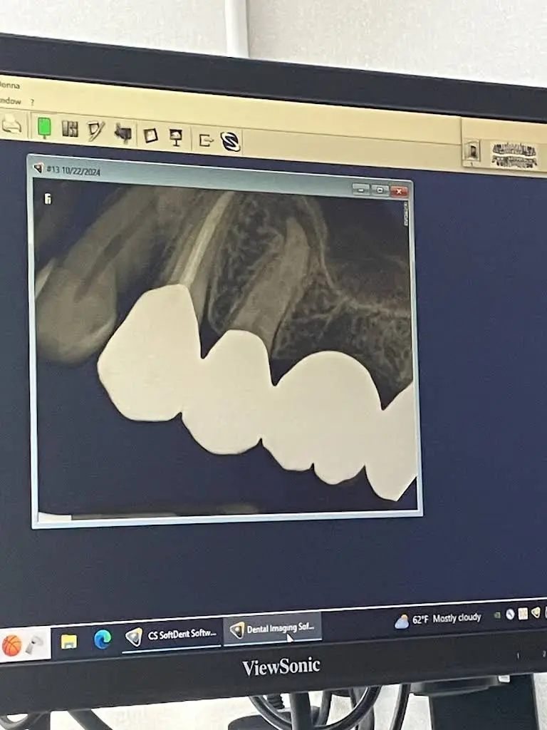 Endodontic Specialists