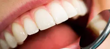 Accent Dental