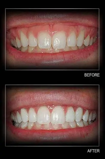 Annapolis Periodontics